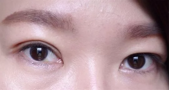 为何生有大小眼的人婚姻生活难稳定？