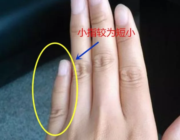 有这三种手相的人运势不佳，日子过得比较辛苦